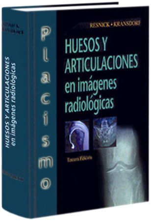 Huesos y Articulaciones en Imágenes Radiológicas